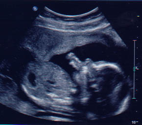 ultrasound1.jpg