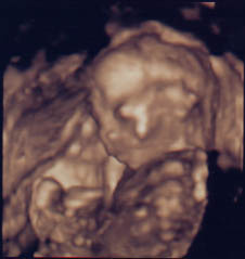 ultrasound2.jpg